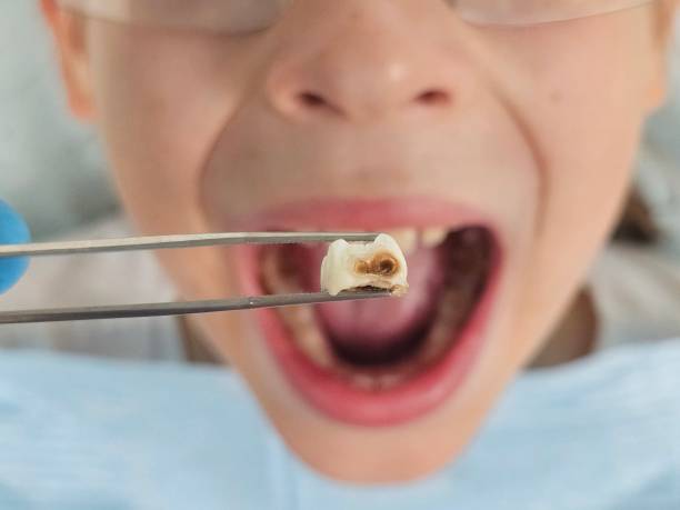 Best Pediatric Emergency Dentist in Adair Village, OR