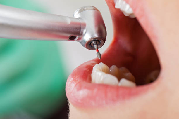 Best Emergency Treatment for Toothache in Adair Village, OR